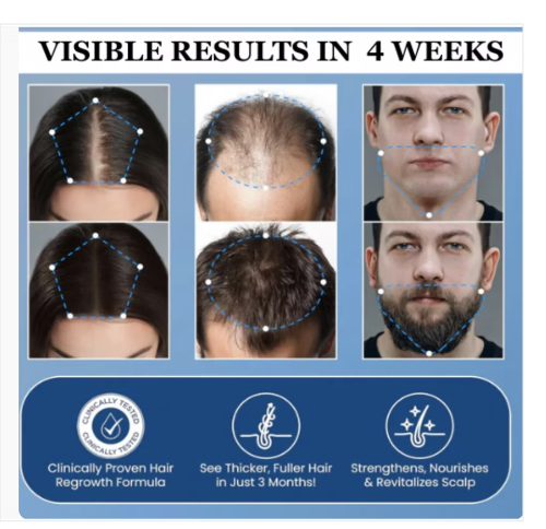 Aparthy Hair Growth Roll-on Serum
